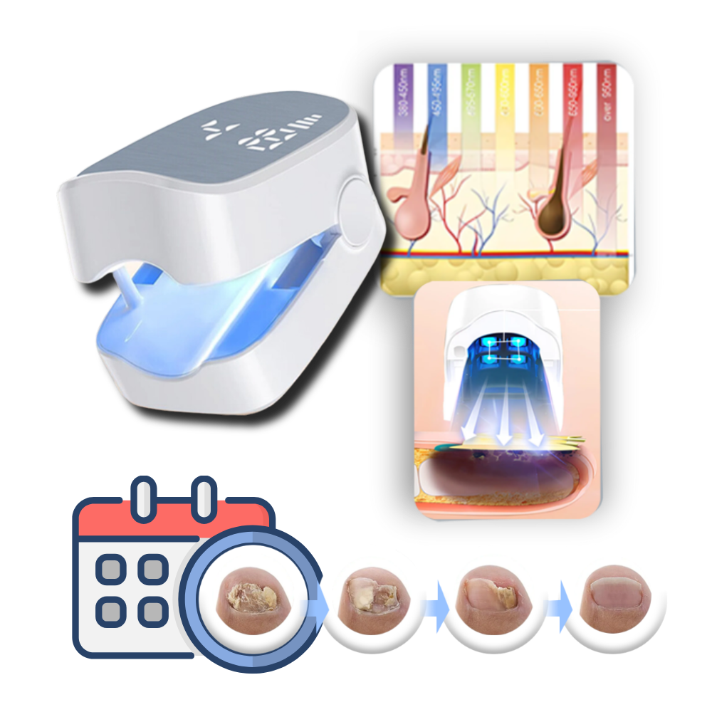 Portable Nail Care Laser Therapy Device With Dual Light Modes - 3