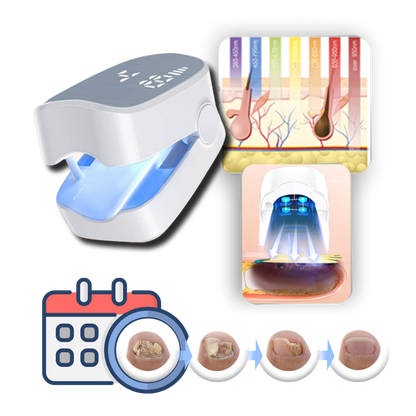 Portable Nail Care Laser Therapy Device With Dual Light Modes - 3