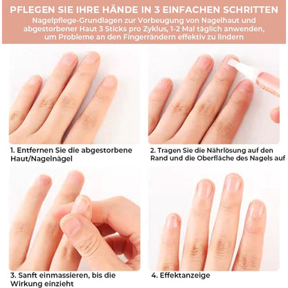 Nail Growth Oil With Vitamin E & B7 For Stronger Longer Nails - Image 9