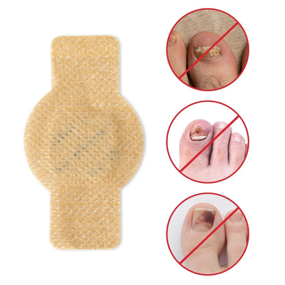 Nail Repair Patches With Antifungal Hydrogel Treatment For Toenails & Fingernails - Image 6