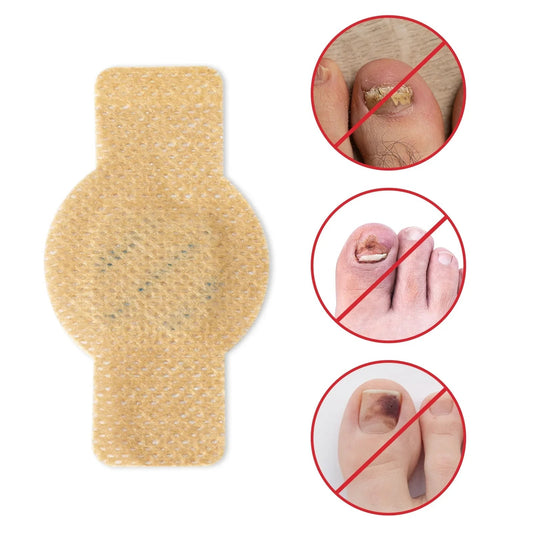 Nail Repair Patches With Antifungal Hydrogel Treatment For Toenails & Fingernails - Image 6