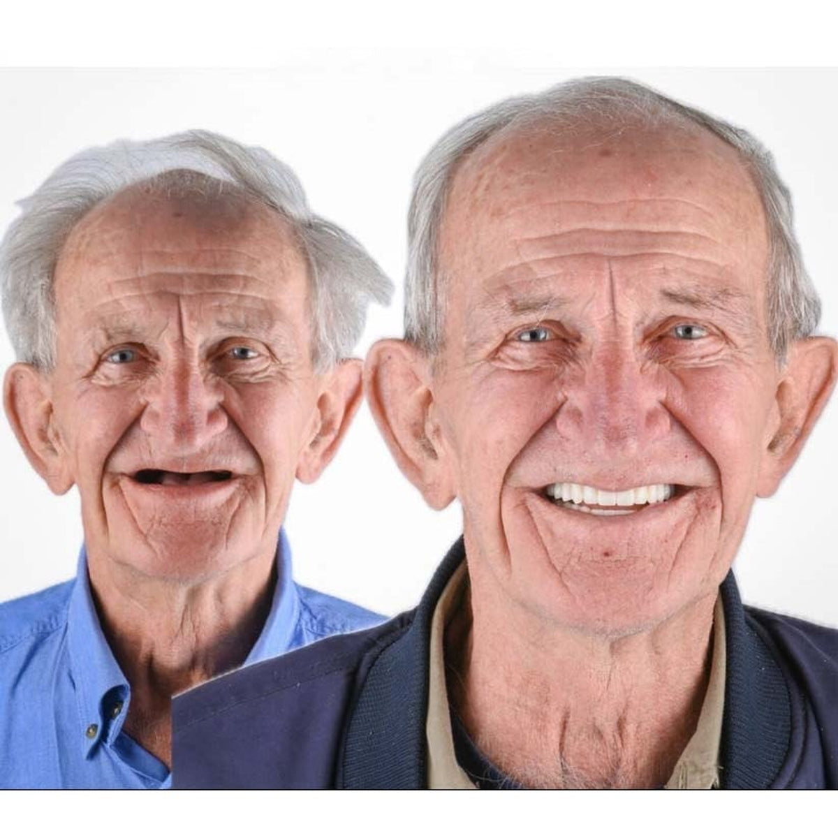 Removable Dentures With Flexible Cushion Grip Full Arch Set - Image 12