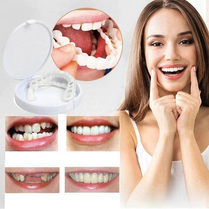 Snap On Veneers For Immediate Smile Correction - Image 2