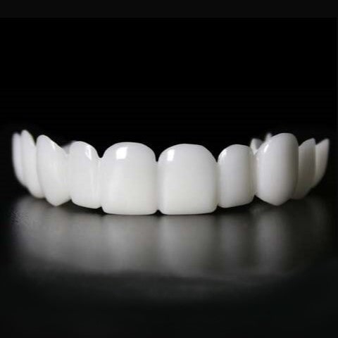Snap On Veneers For Immediate Smile Correction - Image 3