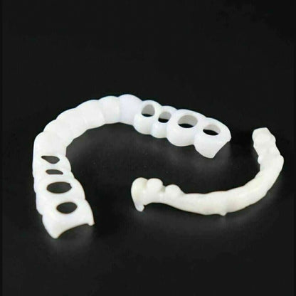 Snap On Veneers For Immediate Smile Correction - Image 5