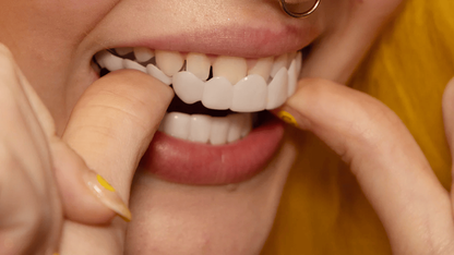 Snap On Veneers For Immediate Smile Correction - Image 7
